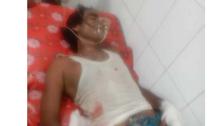 খোকসায় সন্ত্রাসীরা ভেঙেছে সন্ত্রাসীর পা খোকসায় সন্ত্রাসীরা ভেঙেছে সন্ত্রাসীর পা