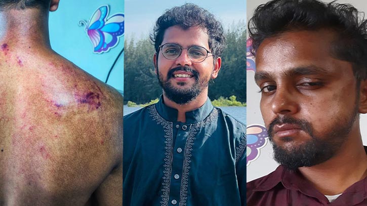 দায়িত্ব পালনকালে দুর্বৃত্তদের হামলার শিকার ইটিভির সাংবাদিক দায়িত্ব পালনকালে দুর্বৃত্তদের হামলার শিকার ইটিভির সাংবাদিক